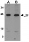LIF Antibody (Internal)