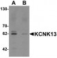 KCNK13 / THIK-1 Antibody (Internal)
