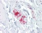 DISPA / DISP1 Antibody (N-Terminus)