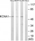KCNA1 / Kv1.1 Antibody (aa256-305)