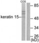 KRT15 / CK15 / Cytokeratin 15 Antibody (aa1-50)