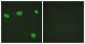 Vitamin D Receptor / VDR Antibody (aa181-230)