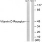 Vitamin D Receptor / VDR Antibody (aa181-230)