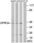 GPR34 Antibody (aa181-230)
