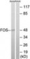 FOS / c-FOS Antibody (aa201-250)