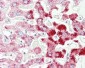 SCP2 / SCPX Antibody (Internal)
