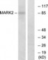 MARK2 Antibody (aa10-59)