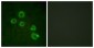 PLA2G4A Antibody (aa471-520)