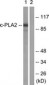 PLA2G4A Antibody (aa471-520)