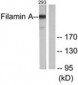 FLNA / Filamin A Antibody (aa2121-2170)