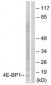 EIF4EBP1 / 4EBP1 Antibody (aa30-79)