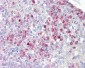 EIF2AK2 / PKR Antibody (aa418-467)