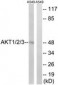 AKT1 + AKT2 + AKT3 Antibody (aa281-330)