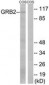 GAB2 Antibody (aa125-174)