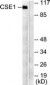 CSE1L Antibody (aa1-50)