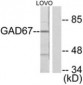GAD1 / GAD67 Antibody (aa471-520)
