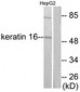 KRT16 / CK16 / Cytokeratin 16 Antibody (aa421-470)