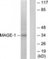 MAGEA1 / MAGE 1 Antibody (aa260-309)