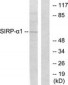 CD172A / SIRPA Antibody (aa451-500)