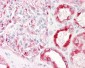 PAK1 Antibody (aa178-227)