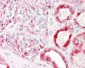 PAK1 Antibody (aa178-227)