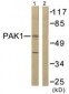 PAK1 Antibody (aa178-227)