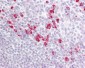 PAK1 + PAK2 + PAK3 Antibody (aa391-440)