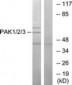 PAK1 + PAK2 + PAK3 Antibody (aa391-440)