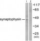 SYP / Synaptophysin Antibody (aa101-150)