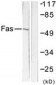 CD95 / FAS Antibody (aa281-330)