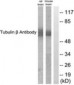 TUBB / Beta Tubulin Antibody (aa401-450)