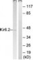 KCNJ11 / Kir6.2 Antibody (aa190-239)