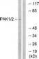 PAK1 Antibody (aa165-214)