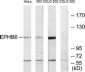 HEP / EPHB6 Antibody (aa861-910)