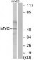 MYC / c-Myc Antibody (aa386-435)