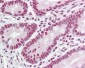 HNRNPL / hnRNP L Antibody (aa61-110)
