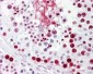 HNRNPL / hnRNP L Antibody (aa61-110)