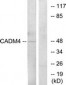 IGSF4C / CADM4 Antibody (aa339-388)