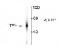 TPH1 / TPH Antibody