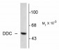 DDC / DOPA Decarboxylase Antibody (N-Terminus)