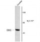 DDC / DOPA Decarboxylase Antibody (N-Terminus)