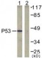 TP53 / p53 Antibody (aa283-332)