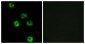 ADGRL2 / LPHN2 Antibody (aa551-600)