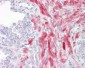 ADGRL2 / LPHN2 Antibody (aa551-600)