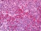 TNF Alpha Antibody