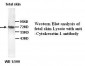 KRT1 / CK1 / Cytokeratin 1 Antibody (Internal)