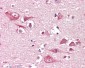 PLCG1 Antibody (clone 2B1)