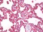 EMA / MUC1 Antibody (clone 214D4)