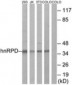 HNRNPD / AUF1 Antibody (aa49-98)