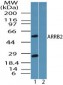 ARRB2 / Beta Arrestin 2 Antibody (aa23-40)